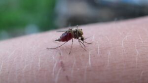 小顔脂肪吸引の効果が出ない原因とは？